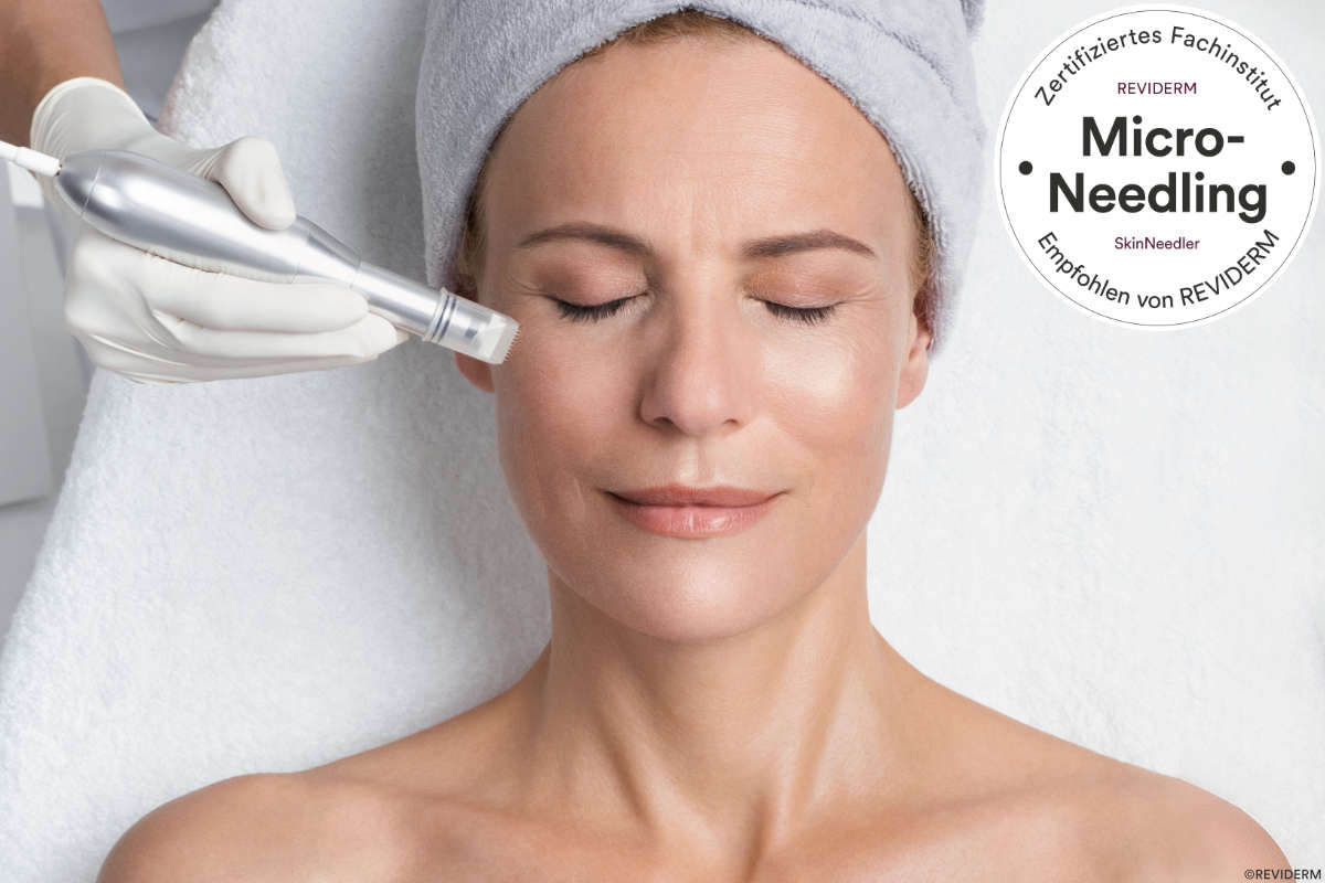 microneedling behandlung