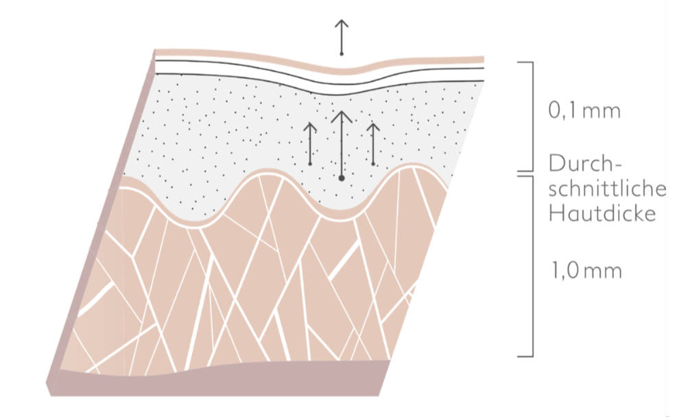 needling